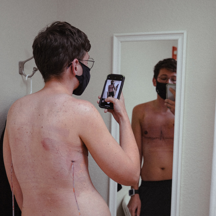 photo of person taking photo of themselves in mirror after surgery